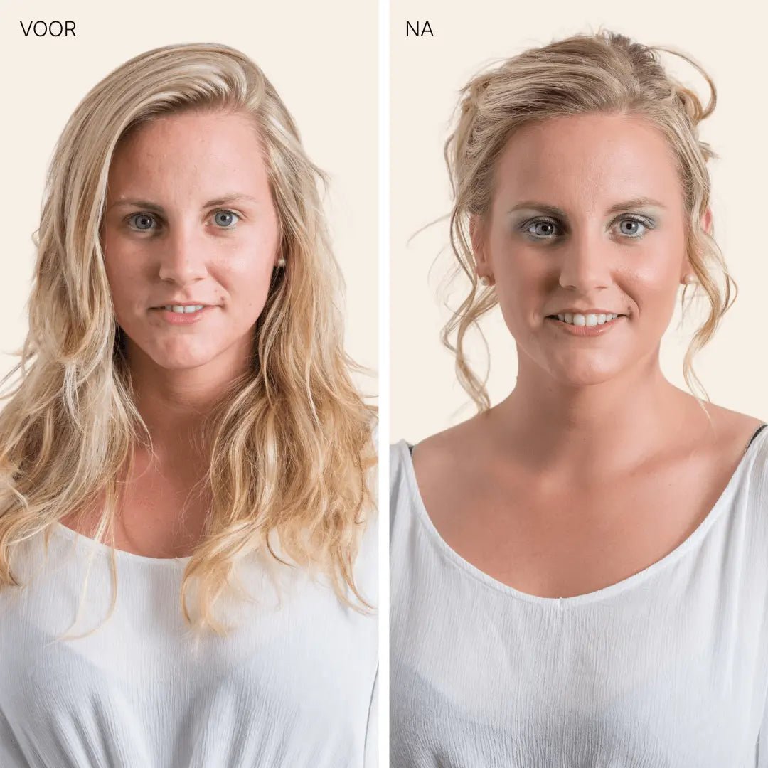 ONRUSTIGE HUID BUNDLE - Mineralissima