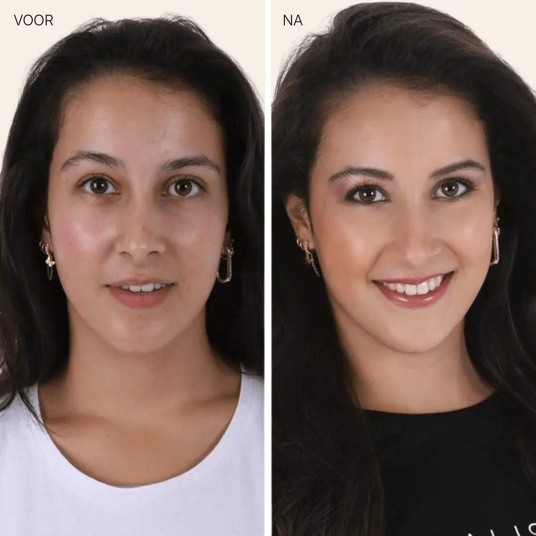 ONRUSTIGE HUID BUNDLE - Mineralissima